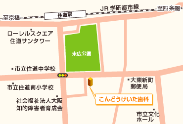 デジタルレントゲン